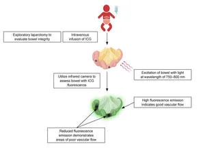 Rethinking surgery for necrotizing enterocolitis in fragile newborns