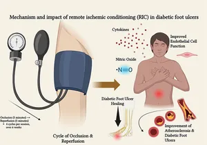 New Research Examines Remote Signal Therapies for Diabetic Foot Ulcer Treatment